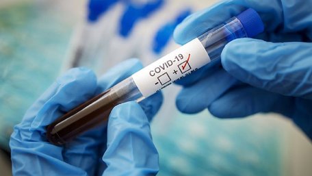 Восьмирічний хлопчик помер від коронавірусу в Коломиї