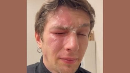 Львів'янка розпилила перцевий балончик в обличчя ветерану за зауваження про сміття