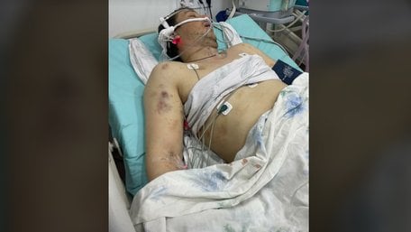 «Він вибіг з намету і почав битися головою об дерево»