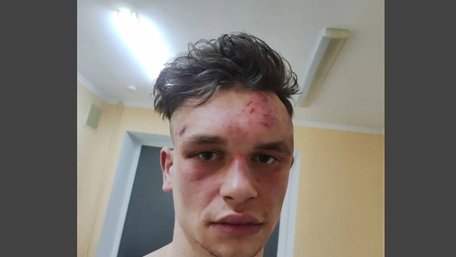 У Львові судили двох поліцейських, які побили стендапера у Винниківському лісі