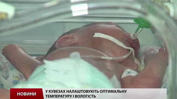 Щороку в Україні 24 тисячі немовлят народжуються передчасно